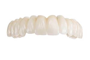 Gzfa - hammasproteesit: mitkä materiaalit ovat parhaita?