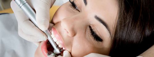 Laskennan muodostuminen, ehkäisyn poistaminen, dentolo